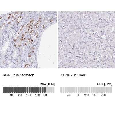 Immunohistochemistry-Paraffin: MiRP1 Antibody [NBP2-38653]