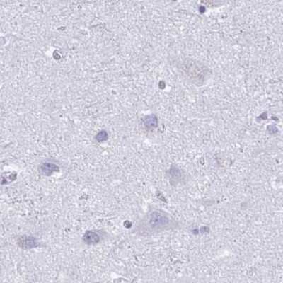 Immunohistochemistry-Paraffin: MiRP1 Antibody [NBP2-38653]