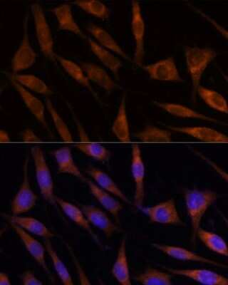 Immunocytochemistry/ Immunofluorescence: Mic1 Antibody - Azide and BSA Free [NBP3-03433]