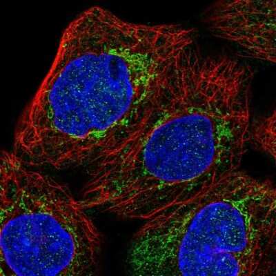 Immunocytochemistry/ Immunofluorescence: Microsomal Glutathione S-transferase 1 Antibody [NBP1-92116]