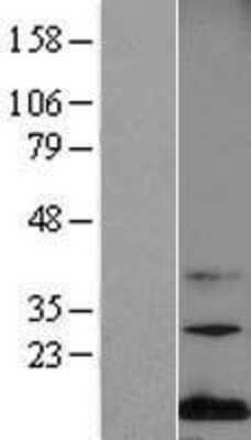 Western Blot: Midkine Overexpression Lysate [NBP2-10999]