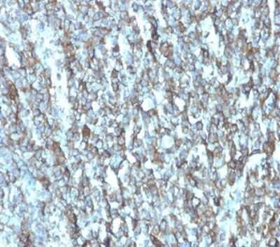 Immunohistochemistry-Paraffin: Migfilin Antibody (FBLIM1/4600) [NBP3-13746]