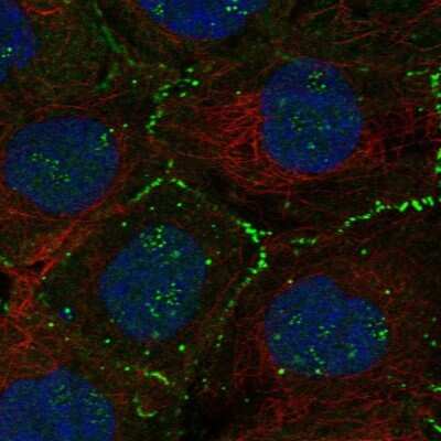 Immunocytochemistry/ Immunofluorescence: Migfilin Antibody [NBP2-57310]
