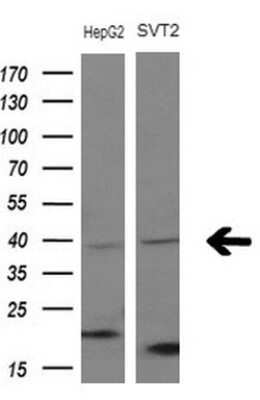 Western Blot: Migfilin Antibody (OTI3G1)Azide and BSA Free [NBP2-72691]