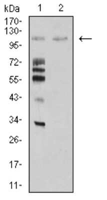 Western Blot: Mind Bomb 1/MIB1 Antibody (6A9C9)BSA Free [NBP2-61864]