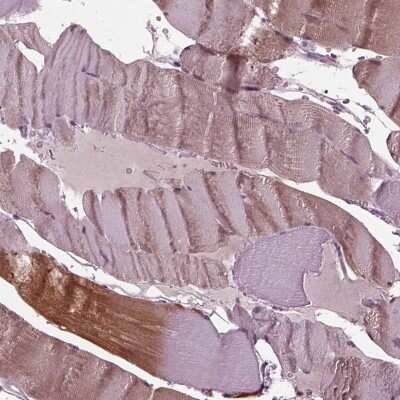 Immunohistochemistry-Paraffin: Mind Bomb 2/MIB2 Antibody [NBP2-57751]