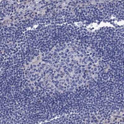 Immunohistochemistry-Paraffin: Mindin/Spondin-2 Antibody [NBP2-30500]