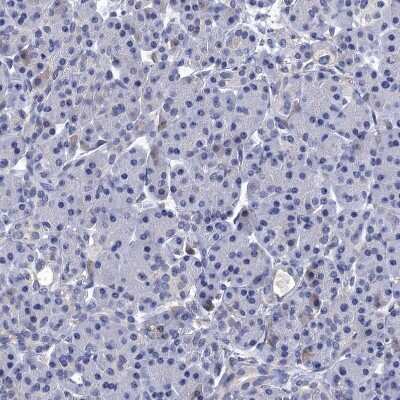 Immunohistochemistry-Paraffin: Mindin/Spondin-2 Antibody [NBP2-30500]