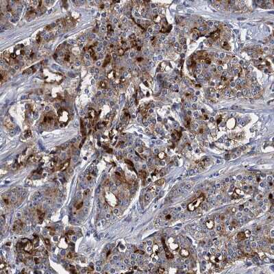 Immunohistochemistry-Paraffin: Mindin/Spondin-2 Antibody [NBP2-30500]
