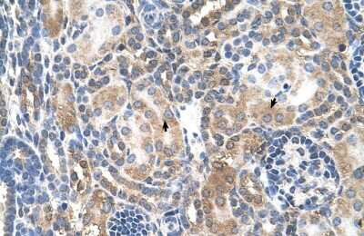 Immunohistochemistry-Paraffin: Mineralocorticoid R/NR3C2 Antibody [NBP1-70640]