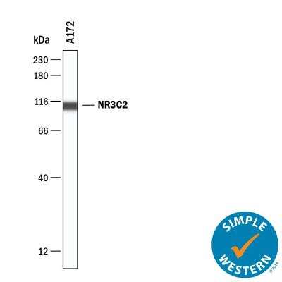 Simple Western: Mineralocorticoid R/NR3C2 Antibody [NBP1-70640]