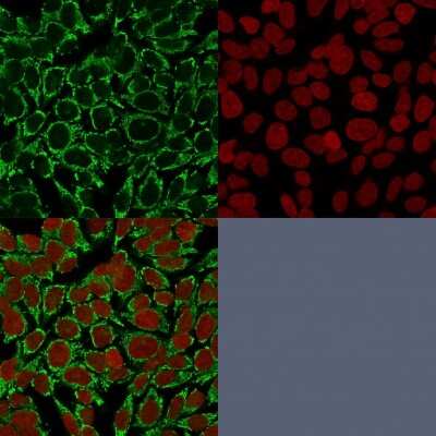 Immunocytochemistry/ Immunofluorescence: Mitochondria Antibody (AE-1) [NBP2-44371]
