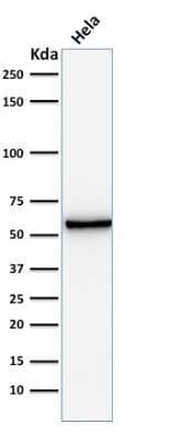Western Blot: Mitochondria Antibody (AE-1) [NBP2-44371]