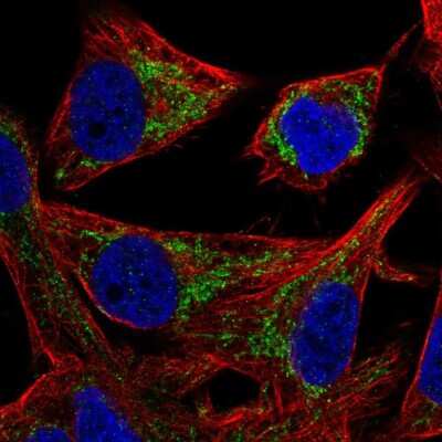 Immunocytochemistry/ Immunofluorescence: Mitochondrial-processing peptidase subunit beta Antibody [NBP2-56461]