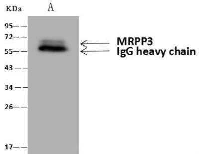 Immunoprecipitation: Mitochondrial ribonuclease P protein 3 Antibody [NBP3-12679]