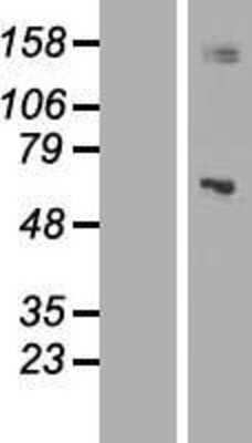 Western Blot: Mitochondrial ribonuclease P protein 3 Overexpression Lysate [NBL1-12244]