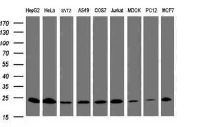 Western Blot: Mitochondrial ribosomal protein L11 Antibody (OTI1E5) [NBP2-45836]