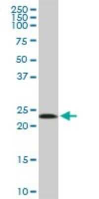 Western Blot: Mitochondrial ribosomal protein L11 Antibody [H00065003-B01P]