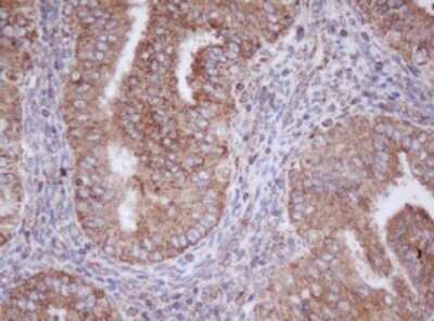 Immunohistochemistry: Mitocondrial Translational Initiation Factor 3 Antibody (OTI4B6) [NBP2-46034]