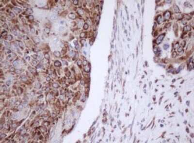 Immunohistochemistry: Mitocondrial Translational Initiation Factor 3 Antibody (OTI4B6) [NBP2-46034]