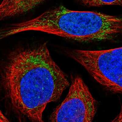 Immunocytochemistry/ Immunofluorescence: Mitocondrial Translational Initiation Factor 3 Antibody [NBP1-92121]