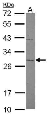 Western Blot: Mitocondrial Translational Initiation Factor 3 Antibody [NBP2-17297]