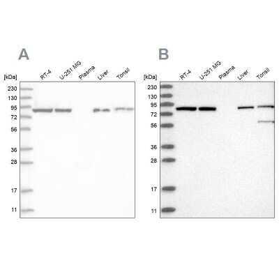 Western Blot: Mitofilin Antibody [NBP2-38285]