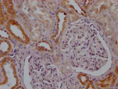 Immunohistochemistry: Mitofusin 2 Antibody (10F6) [NBP3-15201]