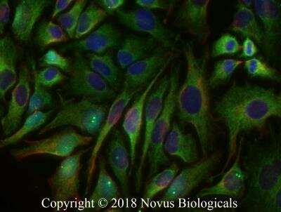Immunocytochemistry/ Immunofluorescence: Mitofusin 2 Antibody - BSA Free [NBP2-66383]