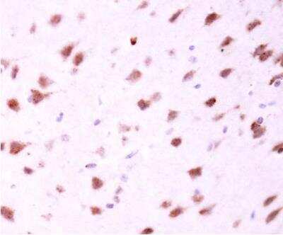 Immunohistochemistry-Paraffin: Mitofusin 2 Antibody [NBP2-17298]