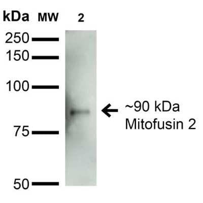 Western Blot: Mitofusin 2 Antibody (S153-5) [NBP2-42188]