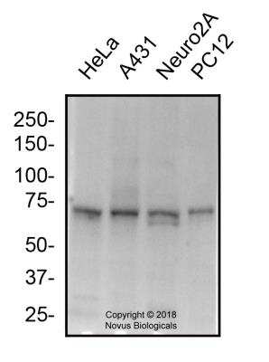 Western Blot: Mitofusin 2 AntibodyBSA Free [NBP2-66383]