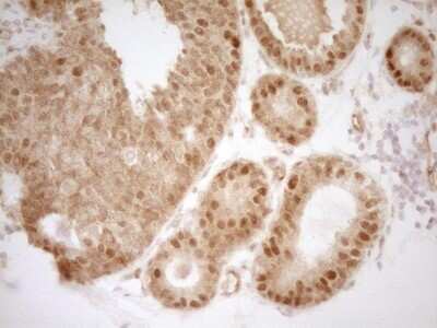 Immunohistochemistry: Mkl1 Antibody (OTI3G7) [NBP2-45862]