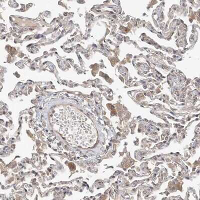 Immunohistochemistry-Paraffin: Mkl1 Antibody [NBP1-88498]