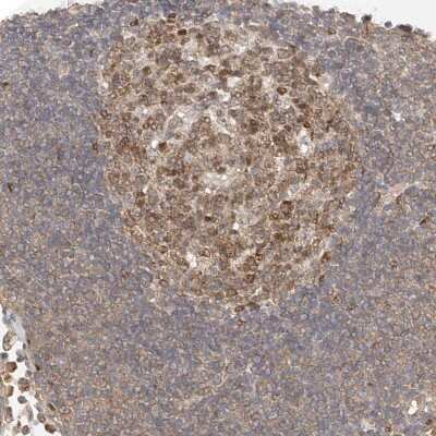 Immunohistochemistry-Paraffin: Mkl1 Antibody [NBP1-88498]