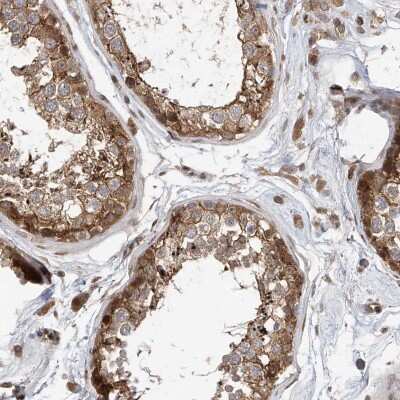 Immunohistochemistry-Paraffin: Mkl1 Antibody [NBP1-88498]