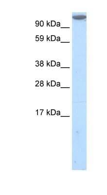 Western Blot: Mkl1 Antibody [NBP1-80259]