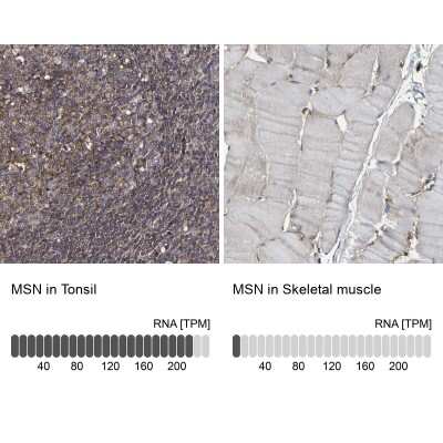 Immunohistochemistry-Paraffin: Moesin Antibody [NBP1-90372]