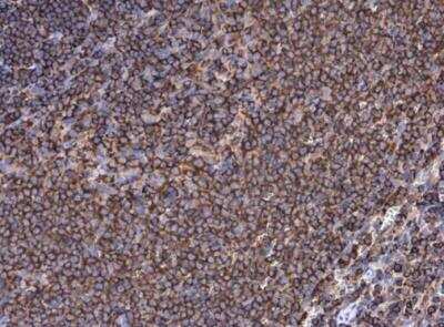 Immunohistochemistry-Paraffin: Moesin Antibody [NBP2-19376]
