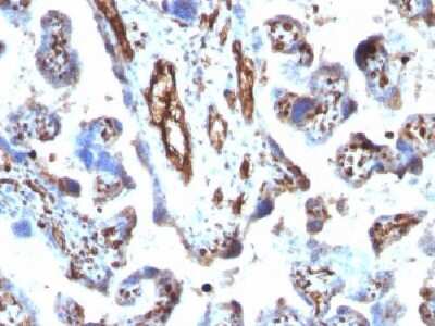 Immunohistochemistry-Paraffin: Moesin Antibody (MSN/491) - Azide and BSA Free [NBP2-34685]