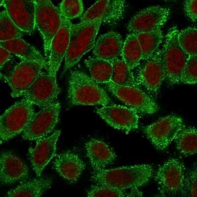 Immunocytochemistry/ Immunofluorescence: Moesin Antibody (MSN/491) [NBP2-32875]