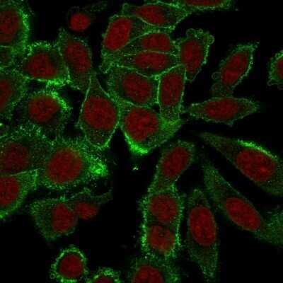 Immunocytochemistry/ Immunofluorescence: Moesin Antibody (MSN/492) - Azide and BSA Free [NBP2-47916]