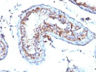 Immunohistochemistry-Paraffin: Moesin Antibody (MSN/492) - IHC-Prediluted [NBP2-48305]