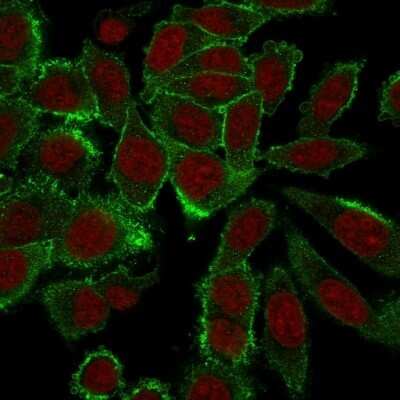 Immunocytochemistry/ Immunofluorescence: Moesin Antibody (MSN/492) [NBP2-44579]