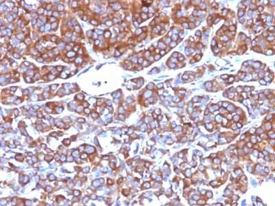 Immunohistochemistry-Paraffin: Moesin Antibody (MSN/492) [NBP2-44579]