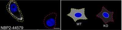 Knockout Validated: Moesin Antibody (MSN/492) [NBP2-44579]