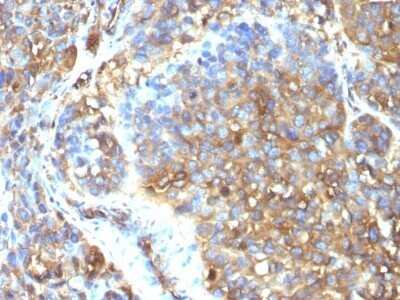 Immunohistochemistry-Paraffin: Moesin Antibody (MSN/493) - Azide and BSA Free [NBP2-47917]