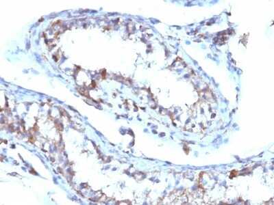 Immunohistochemistry-Paraffin: Moesin Antibody (MSN/493) [NBP2-44580]