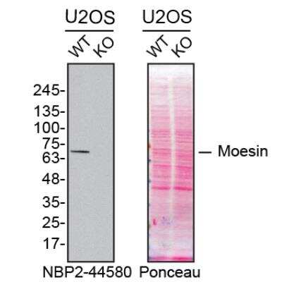 Knockout Validated: Moesin Antibody (MSN/493) [NBP2-44580]