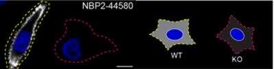 Knockout Validated: Moesin Antibody (MSN/493) [NBP2-44580]